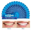 Pack de 13 Tiras blanqueadoras de dientes - My Smile